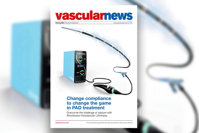Change compliance to change the game in PAD treatment: Overcome the challenge of calcium with Shockwave Intravascular Lithotripsy