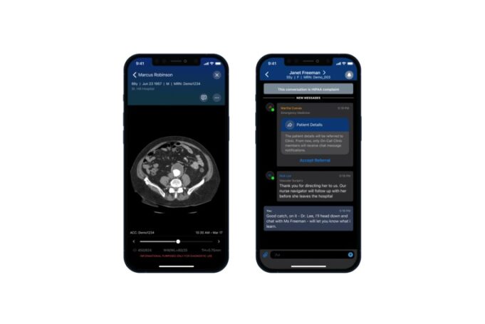 Viz.ai receives FDA 510(k) clearance for abdominal aortic aneurysm AI algorithm algorithm