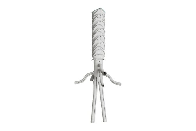 Terumo Aortic announces first implant of custom-made thoracoabdominal hybrid device in North America Thoracoflo