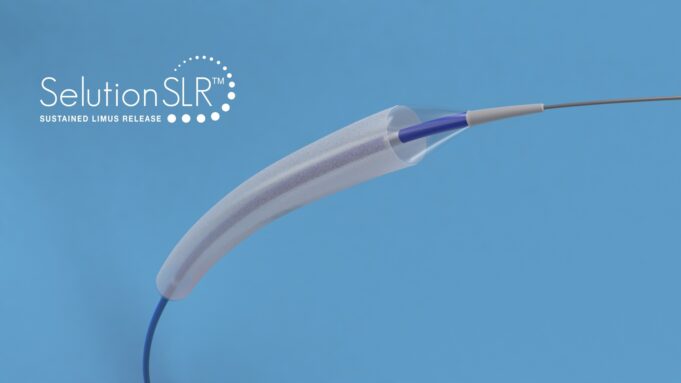 MedAlliance acquired by Cordis