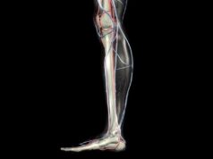 One-year results suggest specialist CLTI clinics are viable alternative to emergency admission