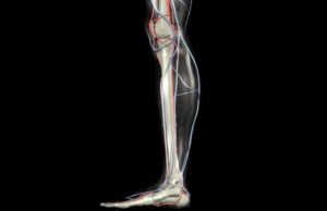 One-year results suggest specialist CLTI clinics are viable alternative to emergency admission