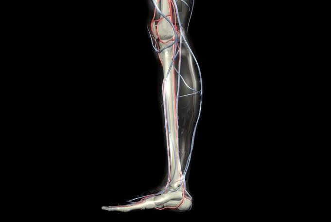 One-year results suggest specialist CLTI clinics are viable alternative to emergency admission