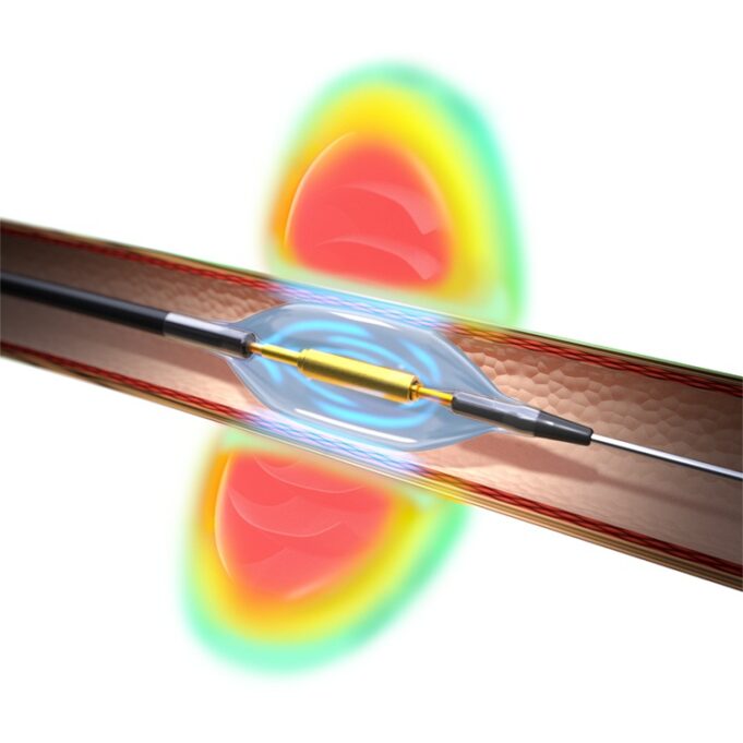 Recor Medical gains first US FDA renal denervation approval