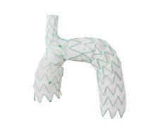 Endospan announces one-year data from TRIOMPHE IDE study TRIOMPHE