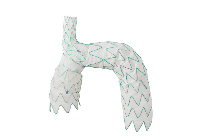 Endospan announces one-year data from TRIOMPHE IDE study TRIOMPHE