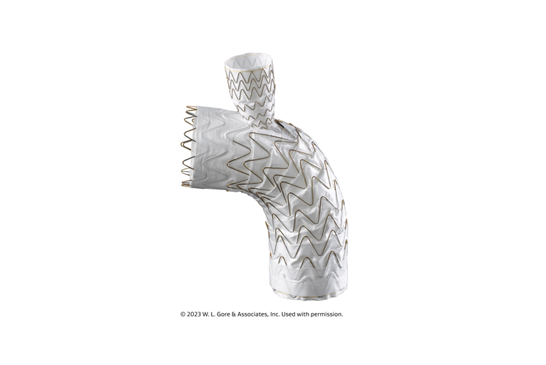 Gore announces first European implantation of Gore Tag thoracic branch endoprosthesis Vascular