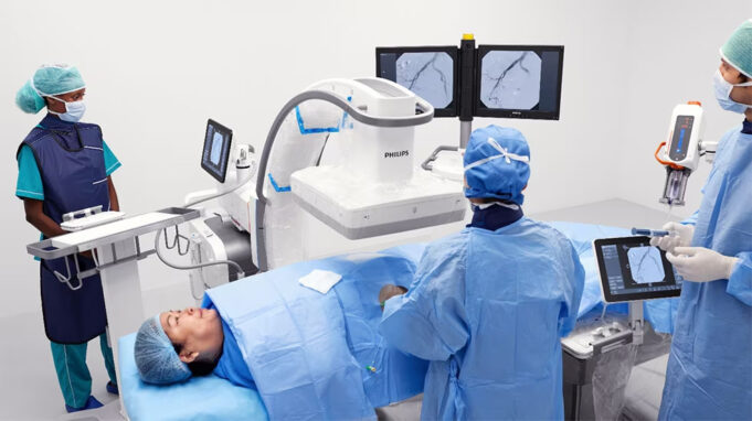 Philips launches new motorised mobile C-arm system