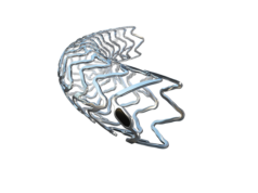 BIOMAG-I two year results confirm safety and efficacy of Biotronik resorbable magnesium scaffold