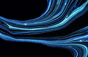 Ultrafast contrast-enhanced ultrasound for PAD patients shows promise in early feasibility research