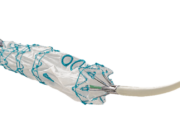 Terumo Aortic announces the first commercial implant of Fenestrated TREO in Asia