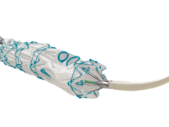 Terumo Aortic announces the first commercial implant of Fenestrated TREO in Asia