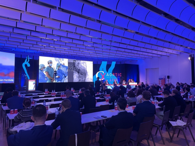 CX Aortic Live blog