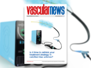 Is it time to rethink your treatment strategy in calcified iliac arteries? L6