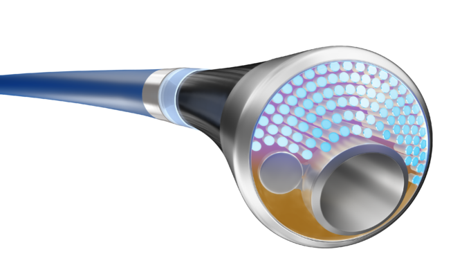 First patient enrolled in study of integrated laser atherectomy and IVL catheter