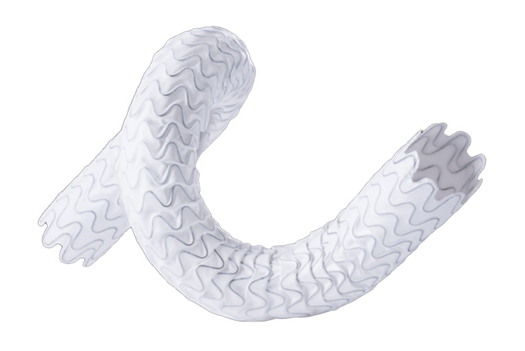 One-year WAVE trial results show patency advantage for Wrapsody versus PTA