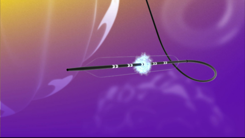 FastWave Medical secures eighth US patent for IVL portfolio