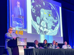 New analysis brings aneurysm rupture prediction closer, but more data needed