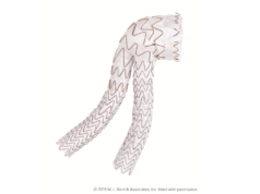 Gore announces first commercial implant of Excluder conformable AAA endoprosthesis with Active Control system in Canada