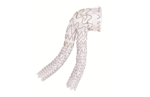 Gore announces first commercial implant of Excluder conformable AAA endoprosthesis with Active Control system in Canada