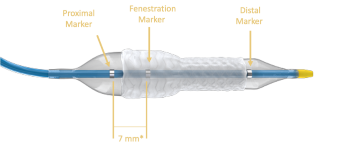 World’s first dedicated FEVAR bridging stent heralds ‘simple, swift and stable’ procedures for all endovascular specialists FEVAR