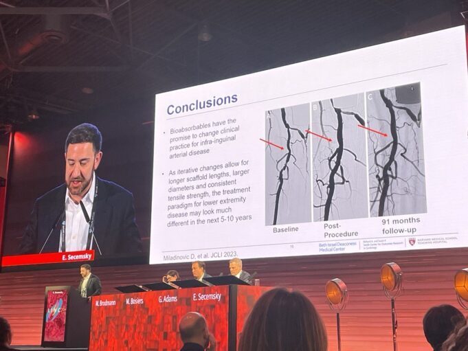 Data and device tweaks herald “practice-changing” future for bioabsorbable scaffolds