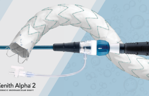 Cook Medical announce first US patient treated with Zenith Alpha 2 endovascular graft