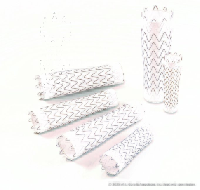 Gore announces US FDA approval and first commercial implant of large-diameter thoracic tapers thoracic