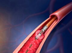 BD to initiate real-world patient registry for Rotarex atherectomy system