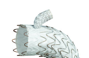 Gore Tag thoracic branch endoprosthesis receives expanded FDA approval for endovascular aortic arch repair