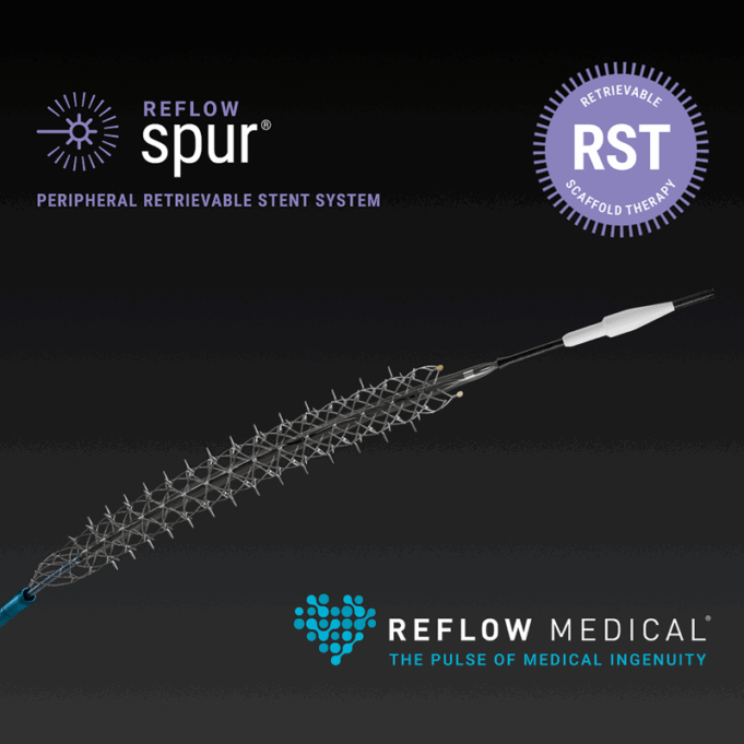 US FDA grants de novo clearance for Reflow Medical’s Spur peripheral retrievable stent system