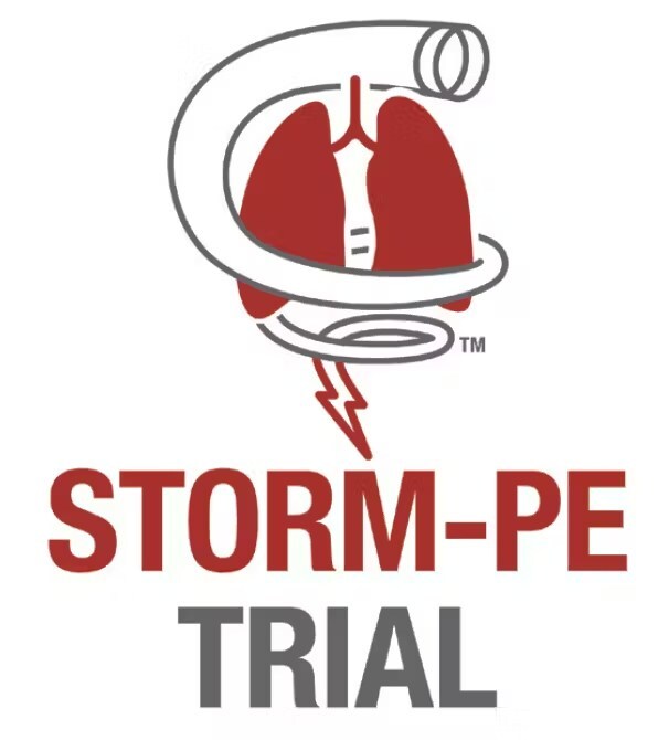 Penumbra’s STORM-PE randomised trial completes enrolment