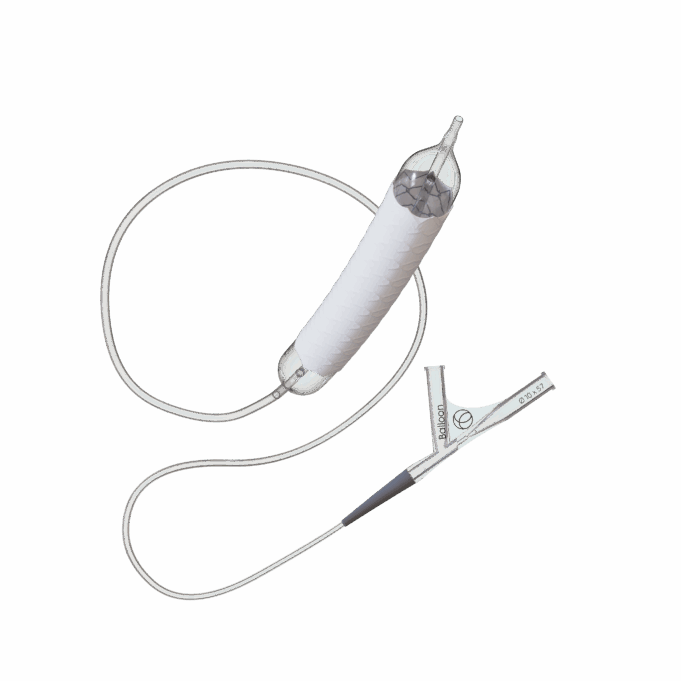 Coverage that counts: Dedicated iliac covered stent opens new chapter in treatment of complex occlusive disease