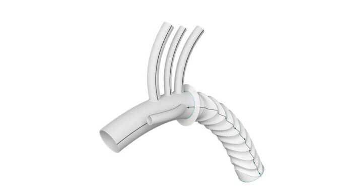 Terumo Aortic announces “significant policy milestone” with CMS establishing new DRG 209 for complex aortic arch procedures