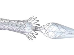 Medtronic fully launches Neuroguard IEP system