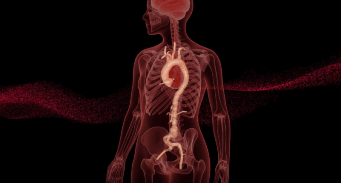 RapidAI earns US FDA clearance for AI-driven aortic measurement and surveillance product