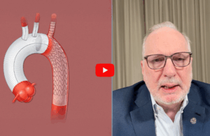 Staged open and TEVAR approach with GORE® TAG® Thoracic Branch Endoprosthesis (TBE) offers “complete and total thoracic solution” in multiple pathologies