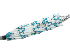 Terumo Aortic announces US FDA Breakthrough Device designation for Fenestrated Treo