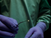 Vena Medical secures US FDA clearance for MicroAngioscope system Vena