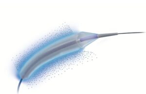 Cordis launches Selution SLR PTA drug-eluting balloon in Japan