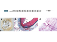 Spur RST: a novel approach to address limitations in BTK CLTI