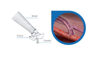 Latest data underscore VasQ’s global clinical impact