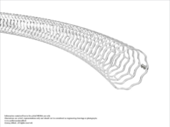 US FDA approves Abbott’s longer-length Esprit for severe PAD