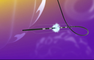 US FDA grants FastWave Medical investigational device exemption for Artero peripheral IVL trial