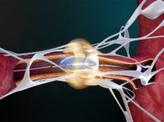 AMA assigns new CPT codes for renal denervation