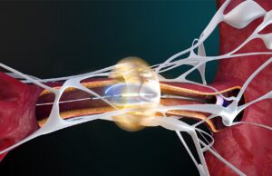 AMA assigns new CPT codes for renal denervation